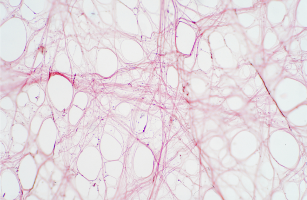 The Liquid Crystalline Collagen Continuum 